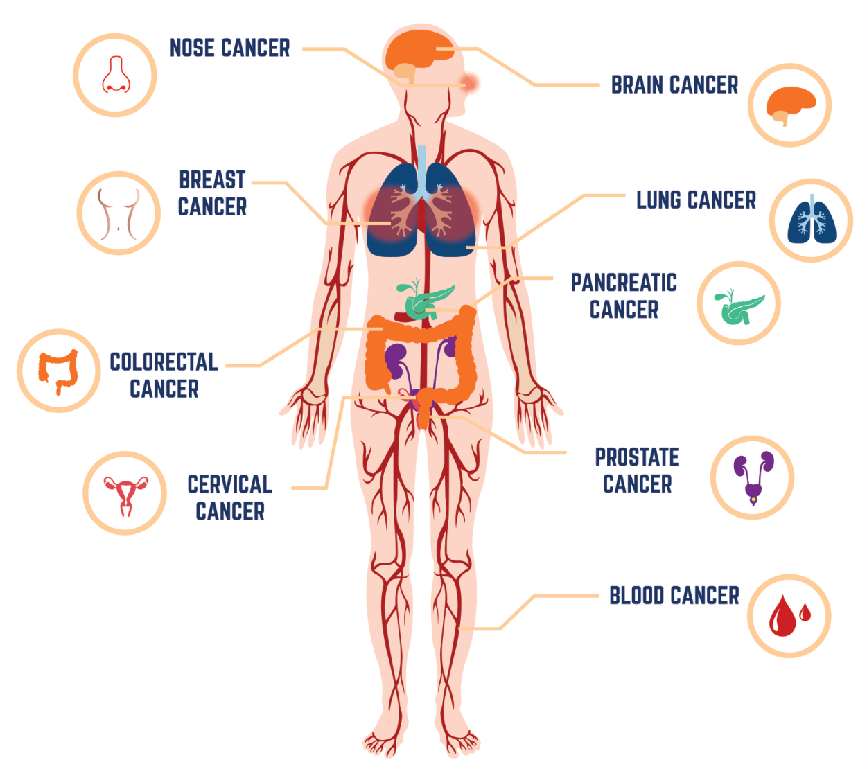 various types of cancer cells, including breast, lung, prostate, and blood cancer